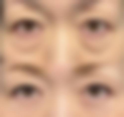 镇江市第三人民医院整形美容科口碑怎么样