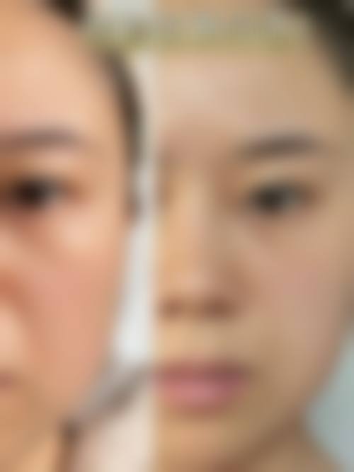 天津市中 医 药研究院附属医院（长征医院）整形皮肤外科口碑怎么样