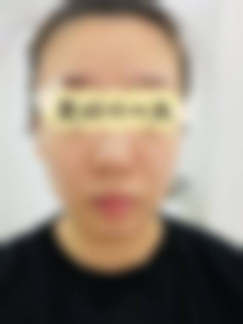 临床实战与真实实例