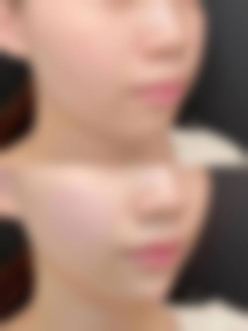 杭州菁漾领美整形医院口碑怎么样