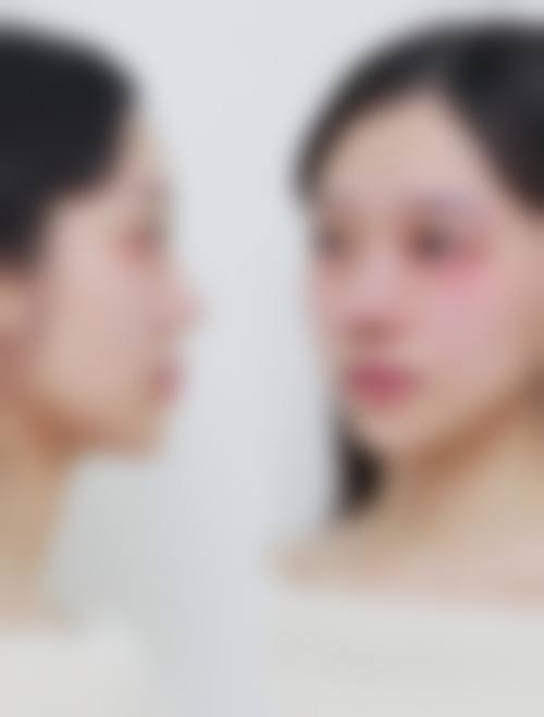 为什么要选择北京悦丽汇医疗美容诊所?