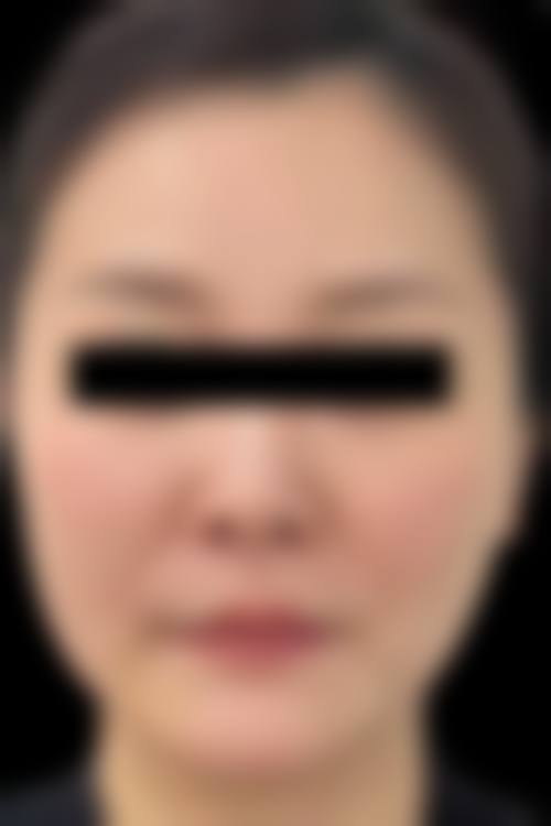 广州星面孔医疗美容门诊收费价格表