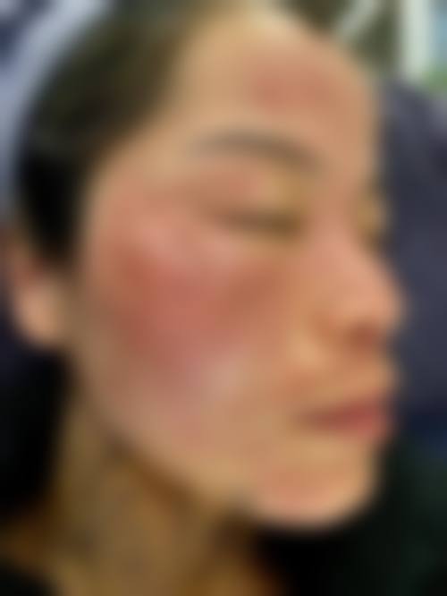 云南省武警边防总队医院整形美容中 心怎么样预约挂号