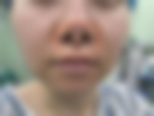 临床实战与真实实例