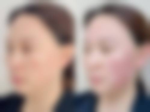 温州东方医院整形美容中 心口碑怎么样